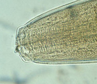 Anisakis simplex worm mouthparts